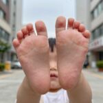 아기 수족구 증상부터 완치까지 완벽 정리 아기 수족구 증상 손바닥 발바닥 수포 발진
